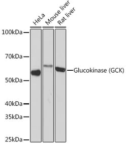 Invitrogen GCK Recombinant Rabbit Monoclonal Antibody (4K9D5) 100 &mu;L;