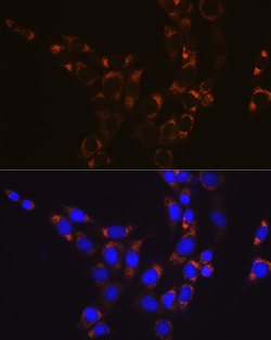 Invitrogen GluD1 Recombinant Rabbit Monoclonal Antibody (7L7N2) 100 &mu;L;