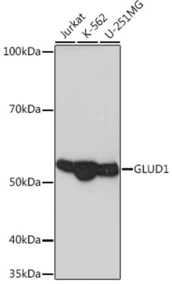 Invitrogen GluD1 Recombinant Rabbit Monoclonal Antibody (7L7N2) 100 &mu;L;