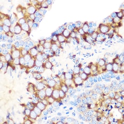 Invitrogen RUVBL1 Recombinant Rabbit Monoclonal Antibody (7Q2U8) 100 &mu;L;