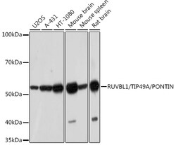 Invitrogen RUVBL1 Recombinant Rabbit Monoclonal Antibody (7Q2U8) 100 &mu;L;