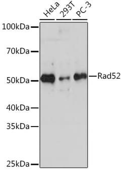 Invitrogen RAD52 Recombinant Rabbit Monoclonal Antibody (7H5K0) 100 &mu;L:Antibodies,
