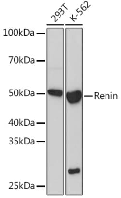 Invitrogen Renin Recombinant Rabbit Monoclonal Antibody (1L1B7) 100 &mu;L | Buy Online | Invitrogen&trade; | Fisher Scientific