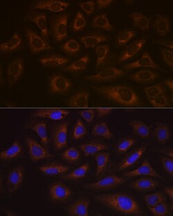Invitrogen UBE2C Recombinant Rabbit Monoclonal Antibody (5G5L9) 100 &mu;L | Buy Online | Invitrogen&trade; | Fisher Scientific