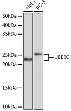 Invitrogen UBE2C Recombinant Rabbit Monoclonal Antibody (5G5L9) 100 &mu;L | Buy Online | Invitrogen&trade; | Fisher Scientific