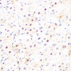 Invitrogen DP1 Recombinant Rabbit Monoclonal Antibody (8C0O3) 100 &mu;L;
