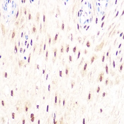 Invitrogen DP1 Recombinant Rabbit Monoclonal Antibody (8C0O3) 100 &mu;L;