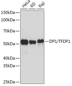 Invitrogen DP1 Recombinant Rabbit Monoclonal Antibody (8C0O3) 100 &mu;L;