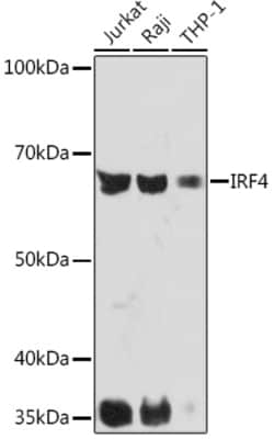 Invitrogen IRF4 Recombinant Rabbit Monoclonal Antibody (2U3G10) 100 &mu;L | Buy Online | Invitrogen&trade; | Fisher Scientific