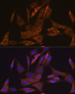 Invitrogen KAP3 Recombinant Rabbit Monoclonal Antibody (1S7J7) 100 &mu;L;