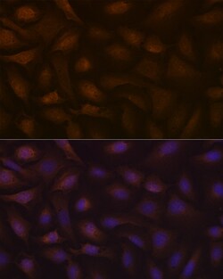 Invitrogen KAP3 Recombinant Rabbit Monoclonal Antibody (1S7J7) 100 &mu;L;