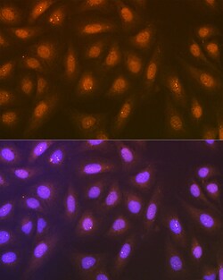 Syntenin 1 Recombinant Rabbit Monoclonal Antibody (ARC1410), Invitrogen