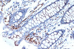 Syntenin 1 Recombinant Rabbit Monoclonal Antibody (ARC1410), Invitrogen