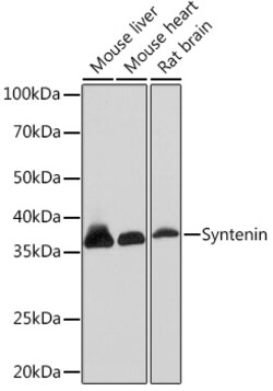 Syntenin 1 Recombinant Rabbit Monoclonal Antibody (ARC1410), Invitrogen