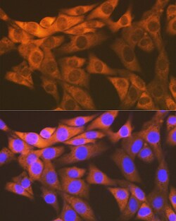 Invitrogen HSPE1 Recombinant Rabbit Monoclonal Antibody (0H0X6) 100 &mu;L:Antibodies,