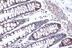 Invitrogen HSPE1 Recombinant Rabbit Monoclonal Antibody (0H0X6) 100 &mu;L:Antibodies,