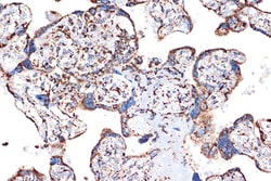 Invitrogen HSPE1 Recombinant Rabbit Monoclonal Antibody (0H0X6) 100 &mu;L:Antibodies,
