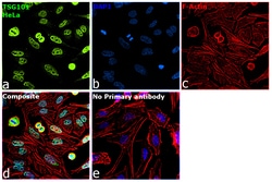 Invitrogen TSG101 Recombinant Rabbit Monoclonal Antibody (4T4W6) 100 &mu;L;