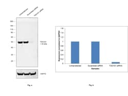 Invitrogen TSG101 Recombinant Rabbit Monoclonal Antibody (4T4W6) 100 &mu;L;