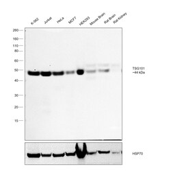 Invitrogen TSG101 Recombinant Rabbit Monoclonal Antibody (4T4W6) 100 &mu;L;