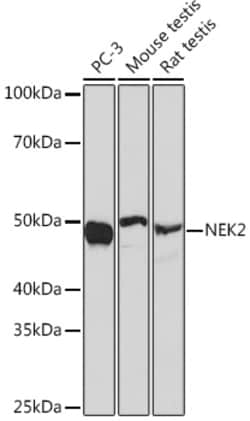 Invitrogen NEK2 Recombinant Rabbit Monoclonal Antibody (5O0A1) 100 &mu;L;