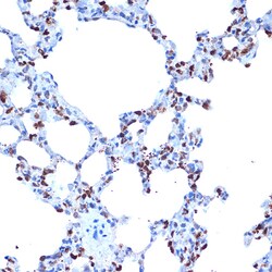 Invitrogen ADAM15 Recombinant Rabbit Monoclonal Antibody (4T4X10) 100 &mu;L;