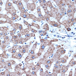 Invitrogen ADAM15 Recombinant Rabbit Monoclonal Antibody (4T4X10) 100 &mu;L;