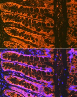 Invitrogen ADAM15 Recombinant Rabbit Monoclonal Antibody (4T4X10) 100 &mu;L;