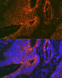 Invitrogen ADAM15 Recombinant Rabbit Monoclonal Antibody (4T4X10) 100 &mu;L;