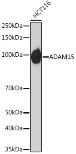 Invitrogen ADAM15 Recombinant Rabbit Monoclonal Antibody (4T4X10) 100 &mu;L;