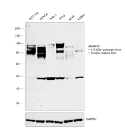 Invitrogen ADAM15 Recombinant Rabbit Monoclonal Antibody (4T4X10) 100 &mu;L;