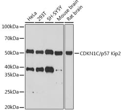 Invitrogen p57 Kip2 Recombinant Rabbit Monoclonal Antibody (6T4E6) 100 &mu;L | Buy Online | Invitrogen&trade; | Fisher Scientific