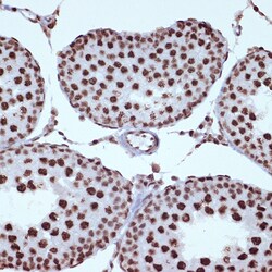 Invitrogen ILF3 Recombinant Rabbit Monoclonal Antibody (0S2N7) 100 &mu;L;
