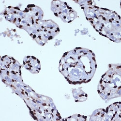 Invitrogen ILF3 Recombinant Rabbit Monoclonal Antibody (0S2N7) 100 &mu;L;