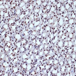 Invitrogen ILF3 Recombinant Rabbit Monoclonal Antibody (0S2N7) 100 &mu;L;