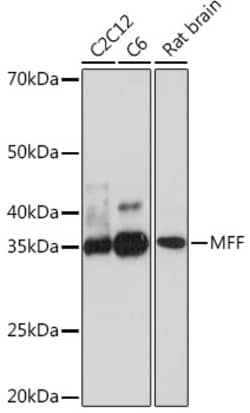 Invitrogen C2orf33 Recombinant Rabbit Monoclonal Antibody (5U5S4) 100 &mu;L;