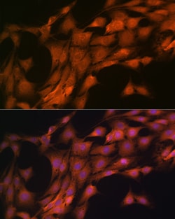 Invitrogen FKBP8 Recombinant Rabbit Monoclonal Antibody (2J7P6) 100 &mu;L;