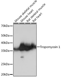 Invitrogen TPM1 Recombinant Rabbit Monoclonal Antibody (5Q2H6) 100 &mu;L | Buy Online | Invitrogen&trade; | Fisher Scientific
