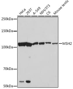Invitrogen MSH2 Recombinant Rabbit Monoclonal Antibody (2L9I4) 100 &mu;L | Buy Online | Invitrogen&trade; | Fisher Scientific