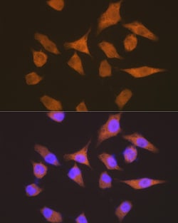 Invitrogen EEF1G Recombinant Rabbit Monoclonal Antibody (2E1O7) 100 &mu;L;