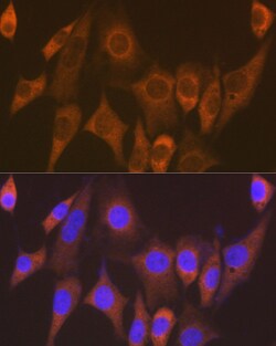 Invitrogen EEF1G Recombinant Rabbit Monoclonal Antibody (2E1O7) 100 &mu;L;