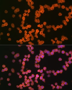 Invitrogen MHC Class I Recombinant Rabbit Monoclonal Antibody (3I1C1) 100