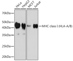 Invitrogen MHC Class I Recombinant Rabbit Monoclonal Antibody (3I1C1) 100