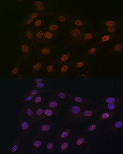 Invitrogen RANGAP1 Recombinant Rabbit Monoclonal Antibody (1E7R7) 100 &mu;L;
