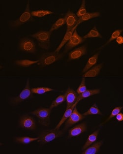 Invitrogen RANGAP1 Recombinant Rabbit Monoclonal Antibody (1E7R7) 100 &mu;L;