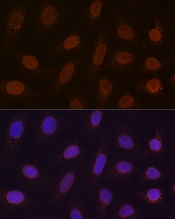 Invitrogen RANGAP1 Recombinant Rabbit Monoclonal Antibody (1E7R7) 100 &mu;L;