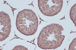 Invitrogen RANGAP1 Recombinant Rabbit Monoclonal Antibody (1E7R7) 100 &mu;L;