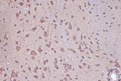 Invitrogen RANGAP1 Recombinant Rabbit Monoclonal Antibody (1E7R7) 100 &mu;L;