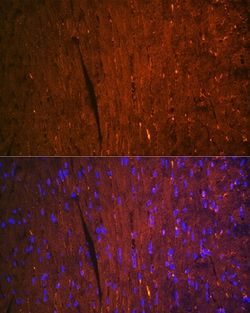 Invitrogen FABP3 Recombinant Rabbit Monoclonal Antibody (9B9D7) 100 &mu;L;