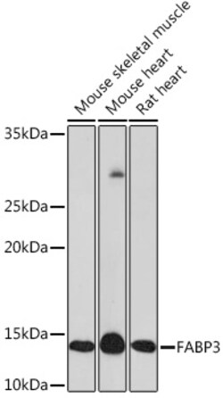 Invitrogen FABP3 Recombinant Rabbit Monoclonal Antibody (9B9D7) 100 &mu;L;